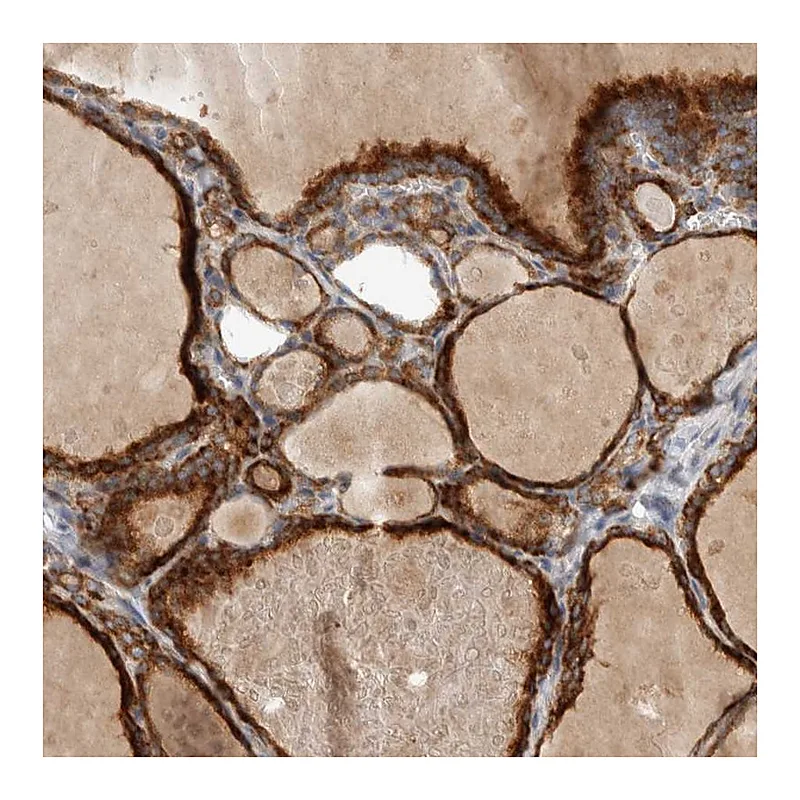 Atlas Antibodies Anti-ADPRM Antibody