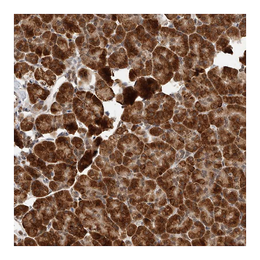 Atlas Antibodies Anti-LRGUK Antibody
