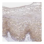 Atlas Antibodies Anti-ADRA2C Antibody