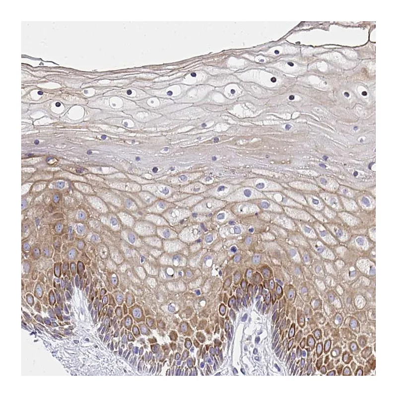 Atlas Antibodies Anti-ADRA2C Antibody