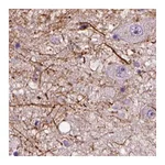 Atlas Antibodies Anti-ADRB3 Antibody