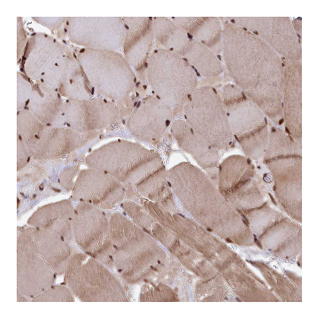 Atlas Antibodies Anti-ADRM1 Antibody