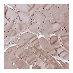 Atlas Antibodies Anti-ADRM1 Antibody
