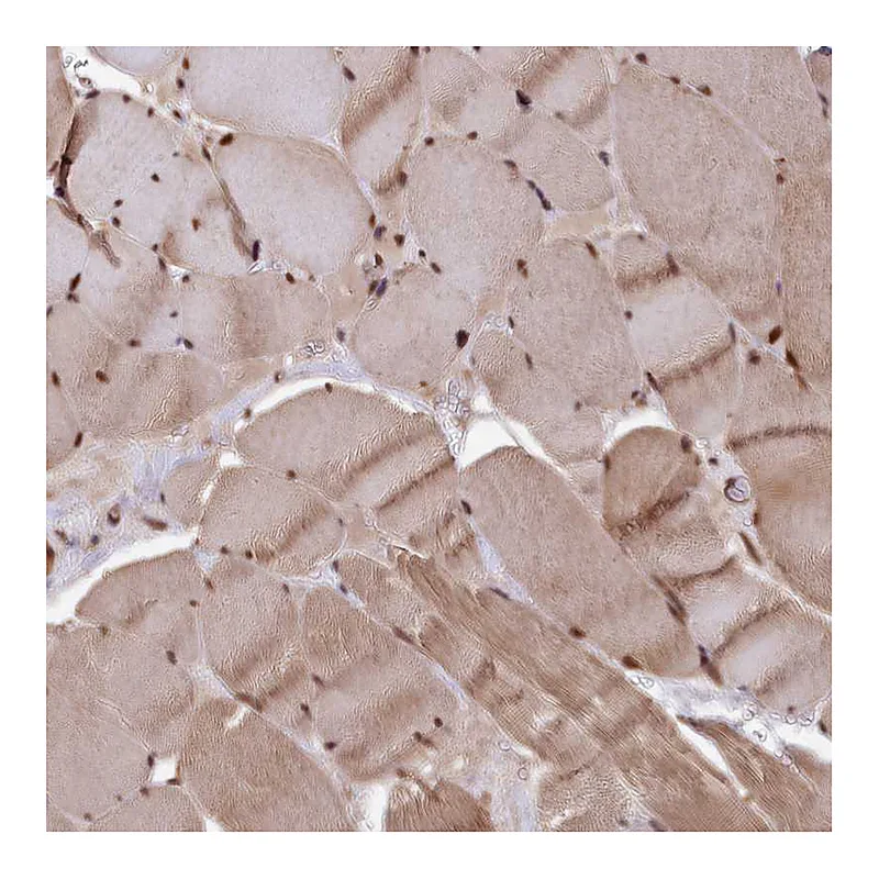 Atlas Antibodies Anti-ADRM1 Antibody