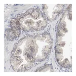 Atlas Antibodies Anti-ADRB2 Antibody