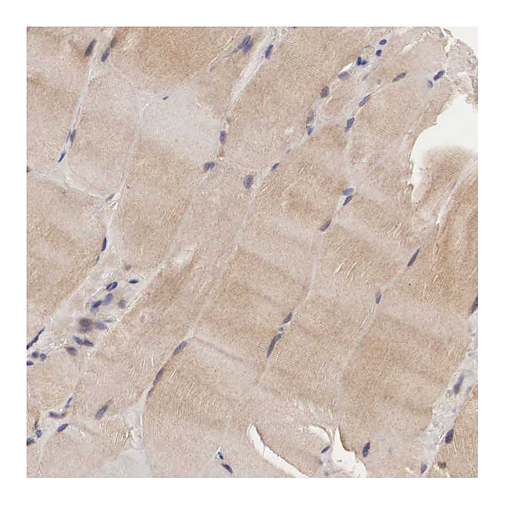 Atlas Antibodies Anti-ADSL Antibody