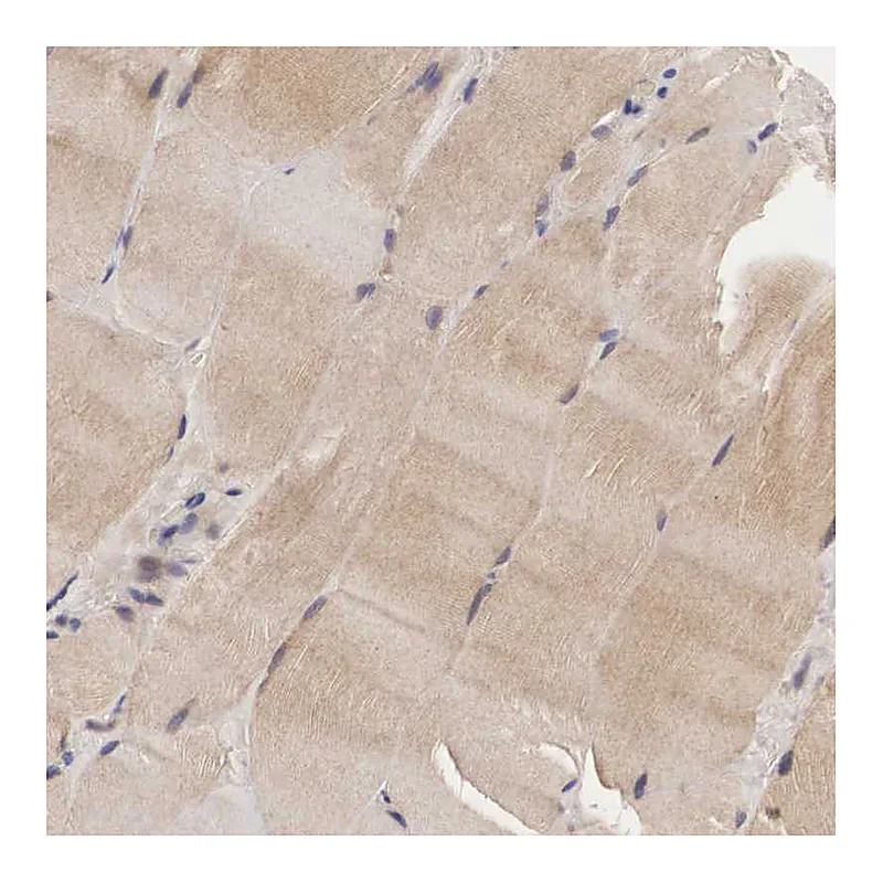 Atlas Antibodies Anti-ADSL Antibody