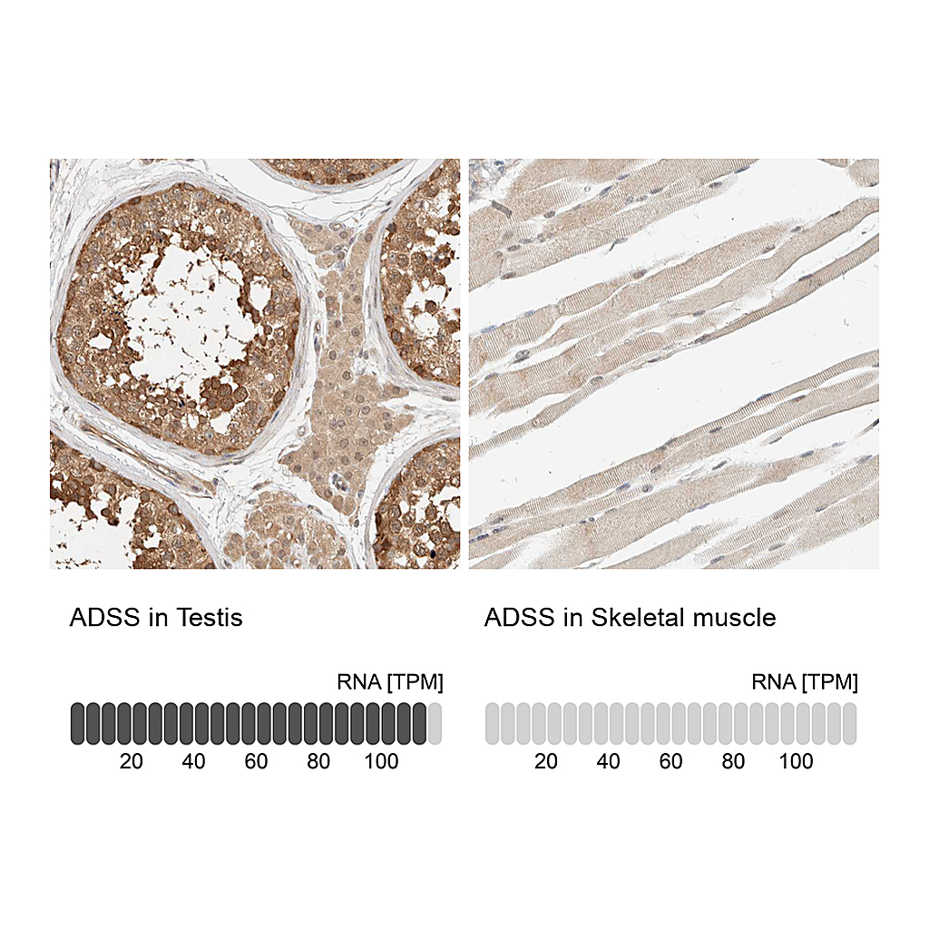 Atlas Antibodies Anti-ADSS Antibody