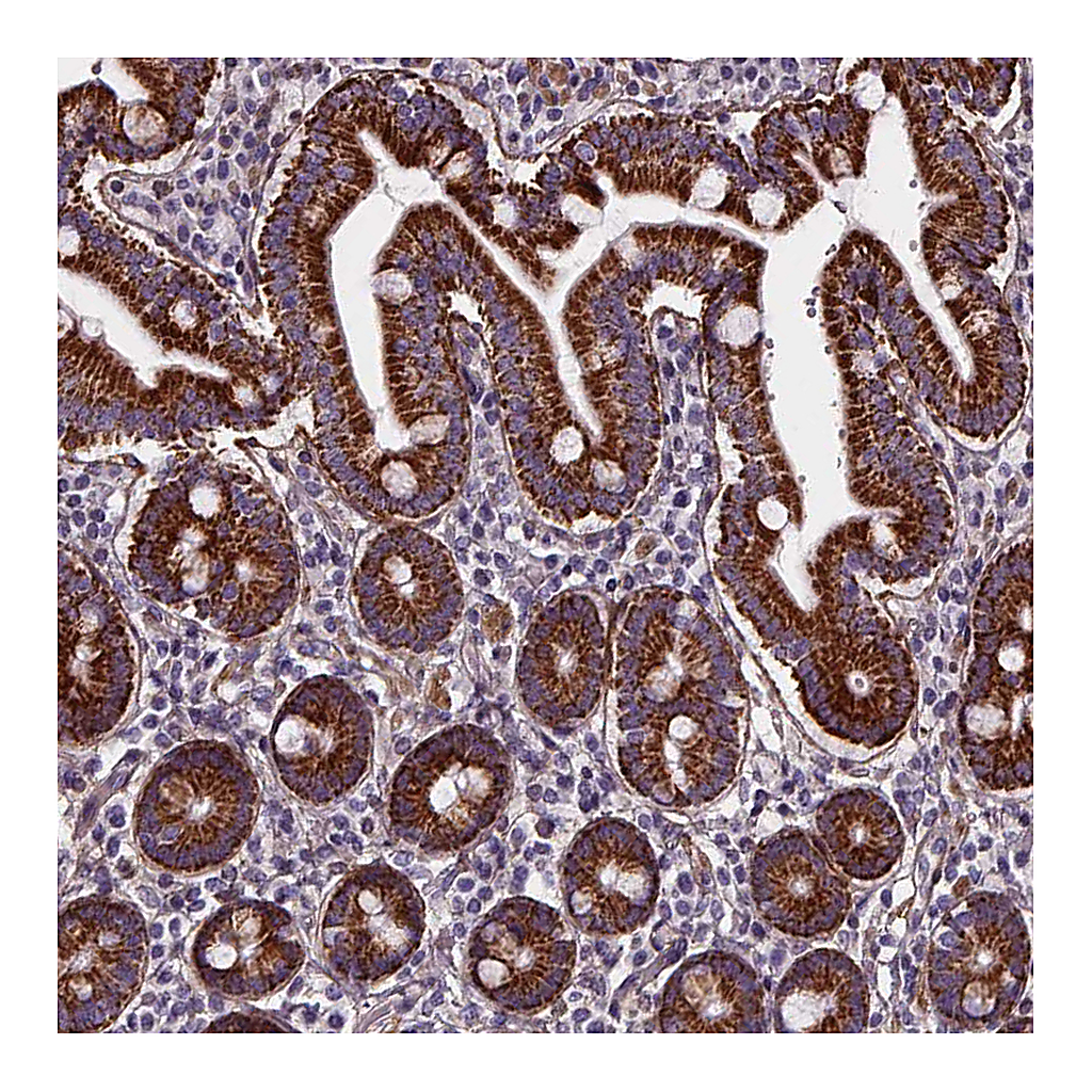 Atlas Antibodies Anti-AEBP1 Antibody