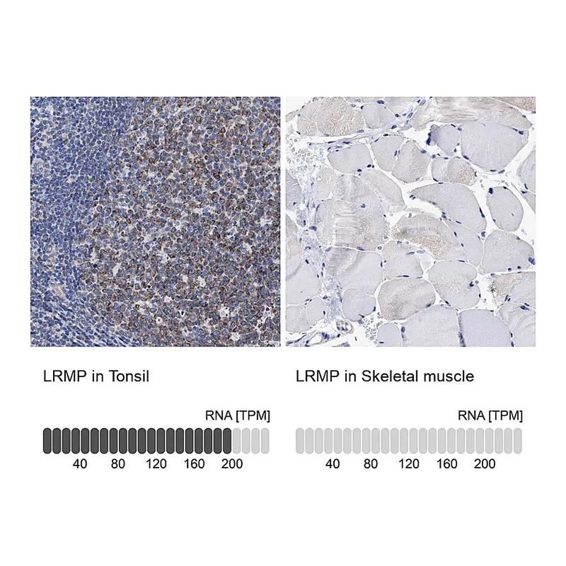 Atlas Antibodies Anti-LRMP Antibody