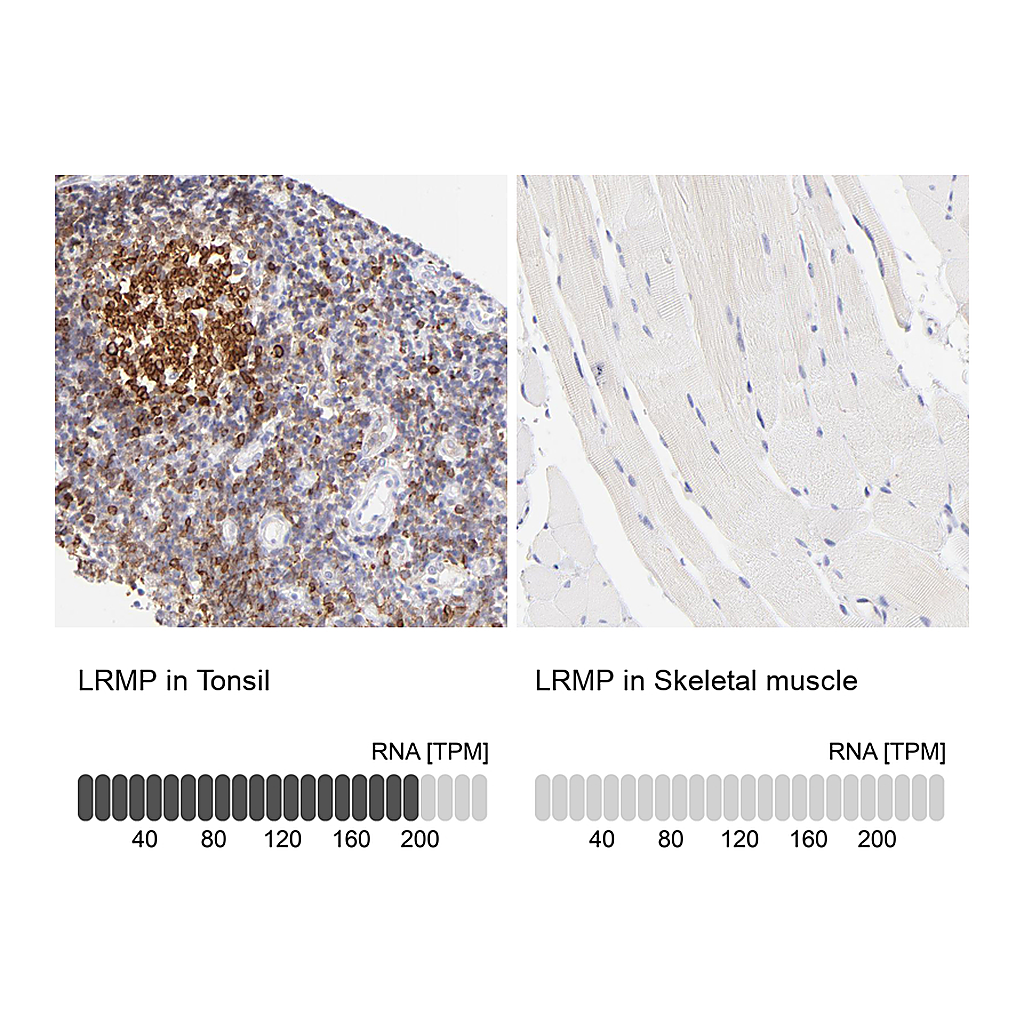 Atlas Antibodies Anti-LRMP Antibody