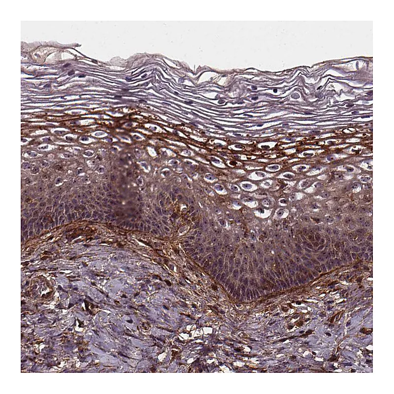 Atlas Antibodies Anti-AEBP1 Antibody