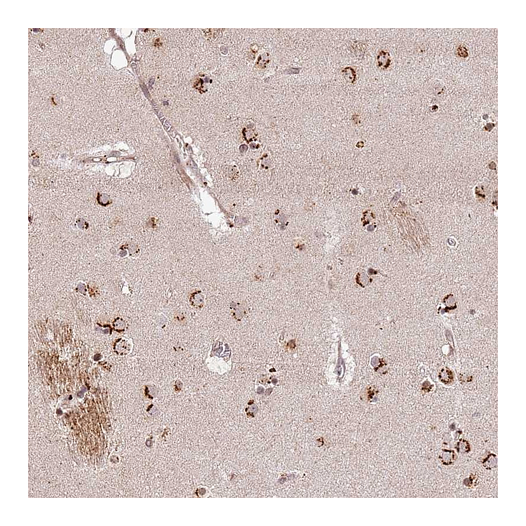 Atlas Antibodies Anti-AF165138.7 Antibody