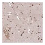 Atlas Antibodies Anti-AF165138.7 Antibody