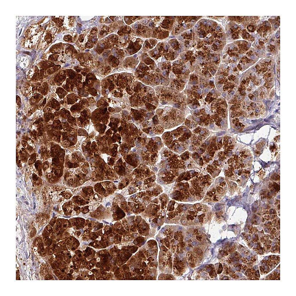 Atlas Antibodies Anti-AEBP2 Antibody