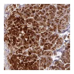 Atlas Antibodies Anti-AEBP2 Antibody