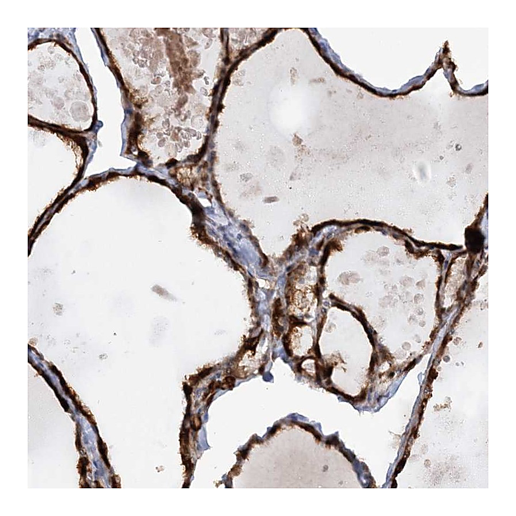 Atlas Antibodies Anti-AFAP1L2 Antibody