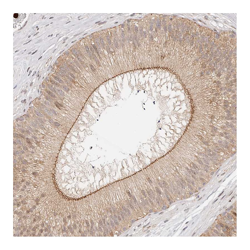 Atlas Antibodies Anti-AFDN Antibody