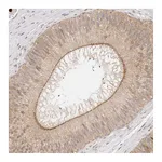 Atlas Antibodies Anti-AFDN Antibody