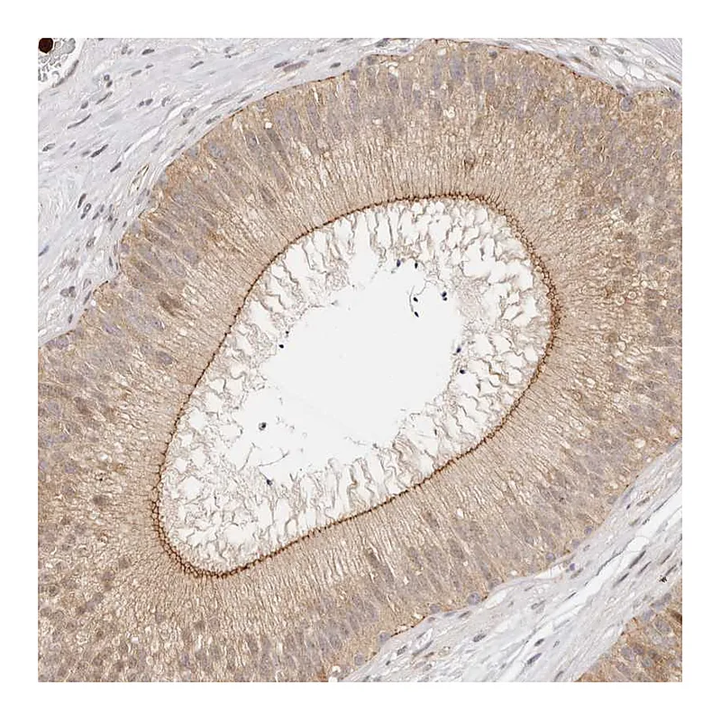 Atlas Antibodies Anti-AFDN Antibody