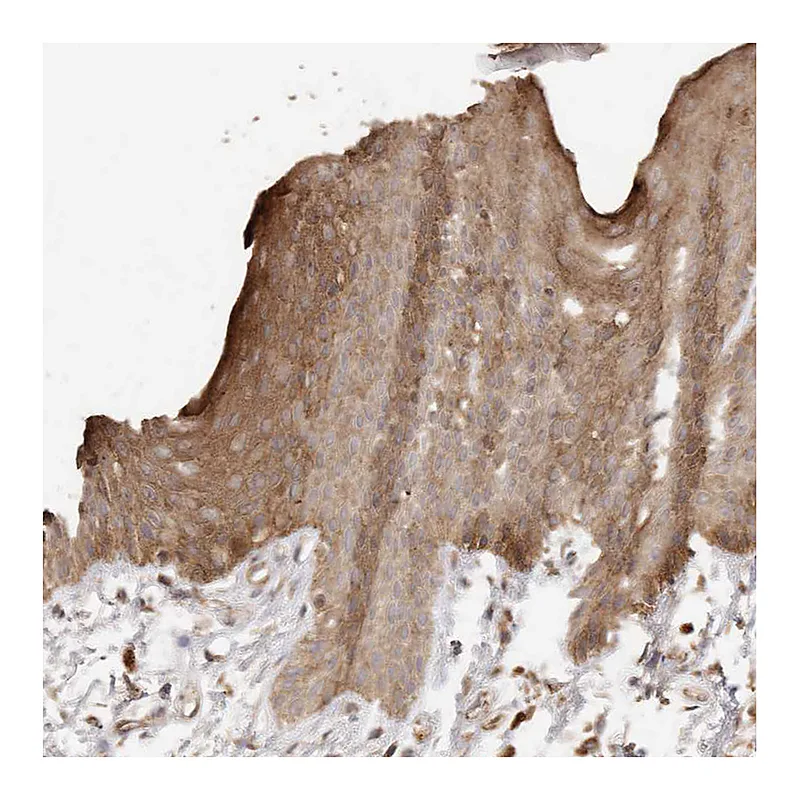 Atlas Antibodies Anti-AFDN Antibody