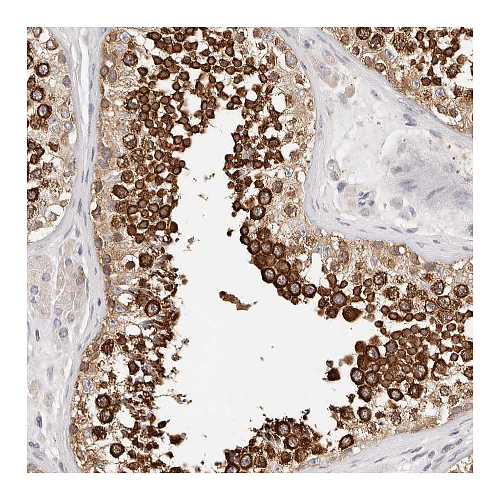 Atlas Antibodies Anti-AFDN Antibody