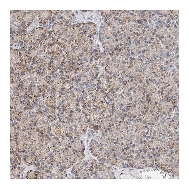 Atlas Antibodies Anti-AFDN Antibody