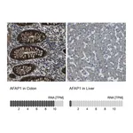 Atlas Antibodies Anti-AFAP1 Antibody
