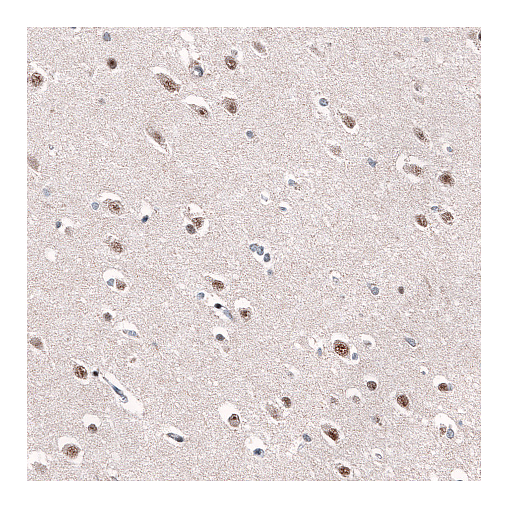 Atlas Antibodies Anti-AFF2 Antibody