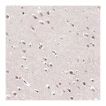 Atlas Antibodies Anti-AFF2 Antibody