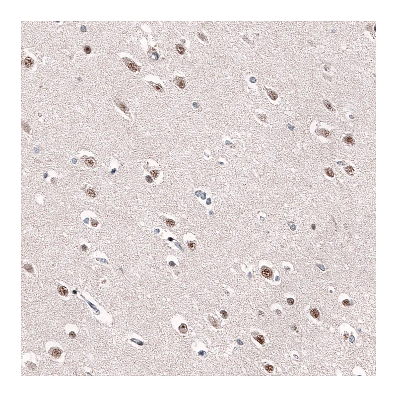Atlas Antibodies Anti-AFF2 Antibody
