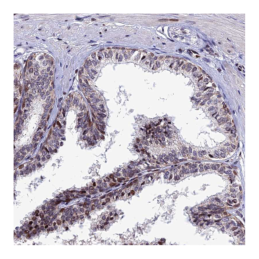Atlas Antibodies Anti-AFF3 Antibody