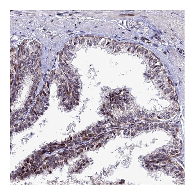Atlas Antibodies Anti-AFF3 Antibody