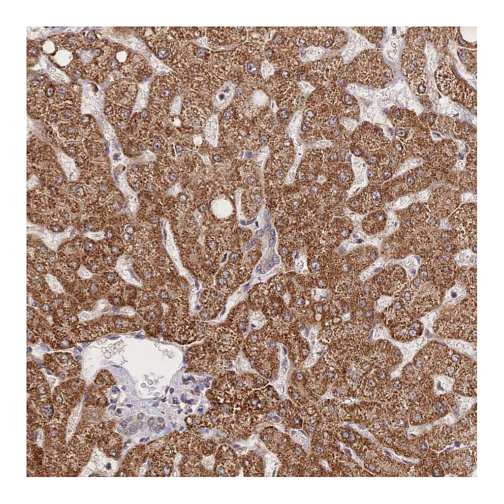 Atlas Antibodies Anti-LRP5 Antibody