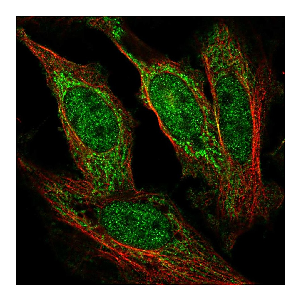 Atlas Antibodies Anti-AFF1 Antibody