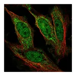 Atlas Antibodies Anti-AFF1 Antibody