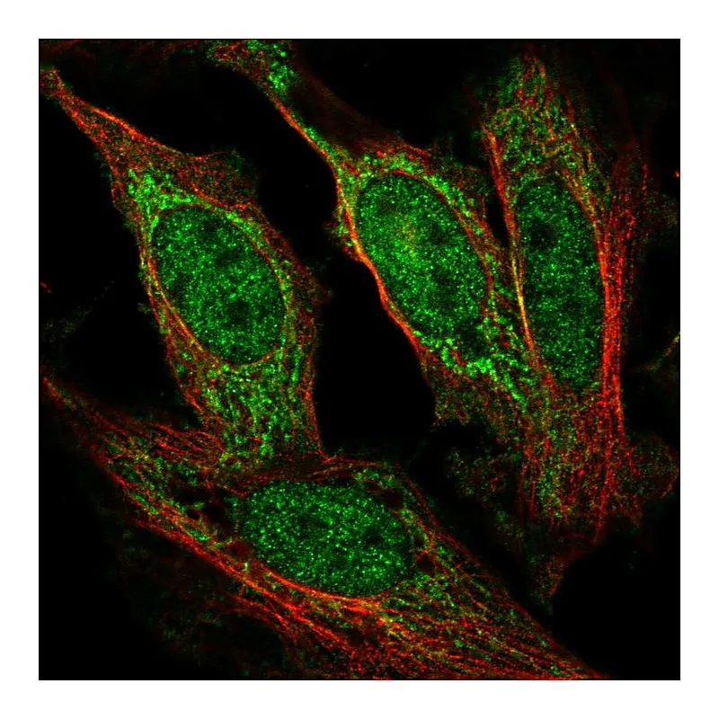 Atlas Antibodies Anti-AFF1 Antibody