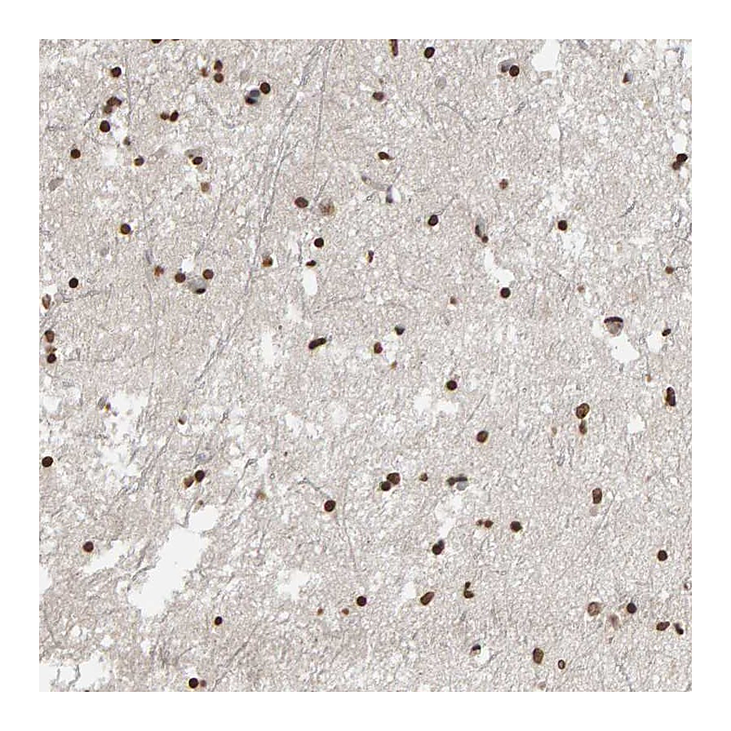 Atlas Antibodies Anti-AFF4 Antibody