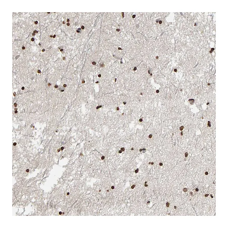 Atlas Antibodies Anti-AFF4 Antibody