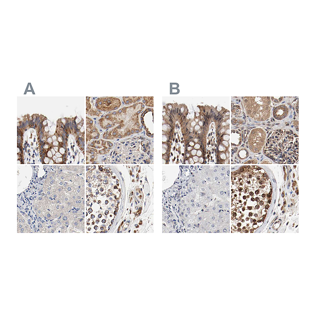 Atlas Antibodies Anti-AFG3L2 Antibody