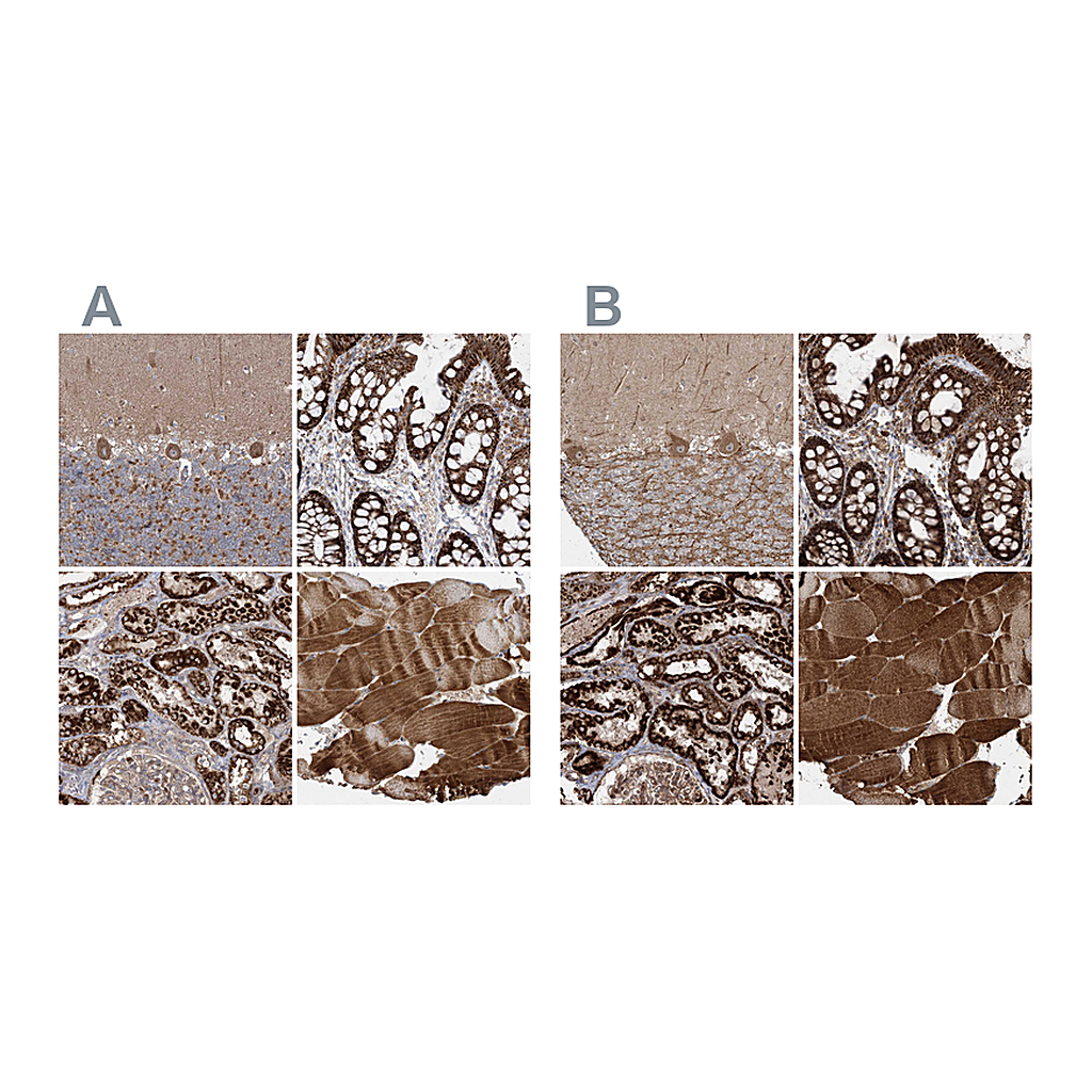 Atlas Antibodies Anti-LRPPRC Antibody