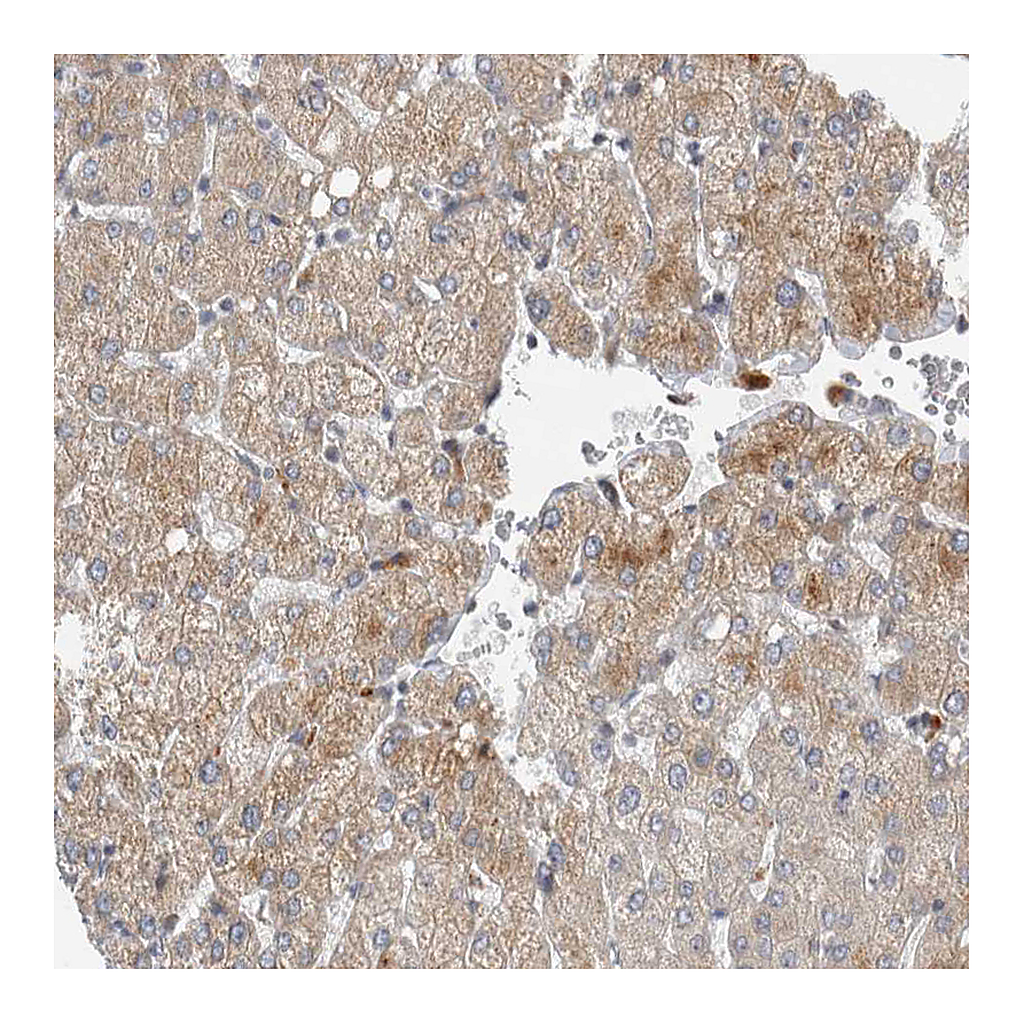 Atlas Antibodies Anti-AFP Antibody