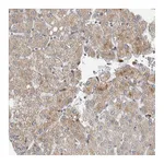 Atlas Antibodies Anti-AFP Antibody