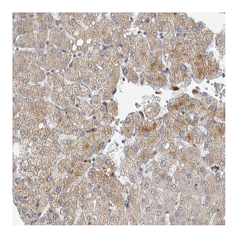 Atlas Antibodies Anti-AFP Antibody