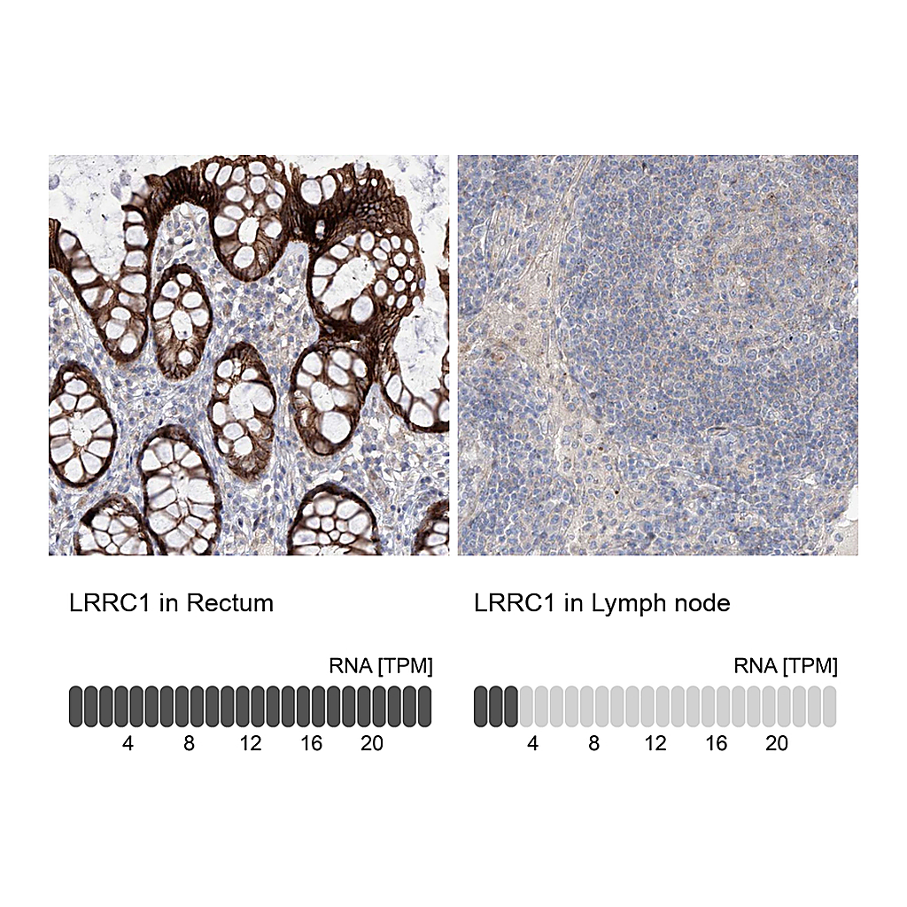 Atlas Antibodies Anti-LRRC1 Antibody