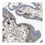 Atlas Antibodies Anti-AFP Antibody