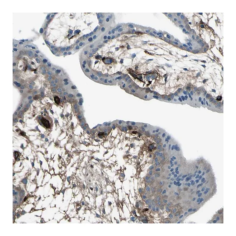 Atlas Antibodies Anti-AFP Antibody