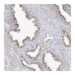 Atlas Antibodies Anti-AFTPH Antibody