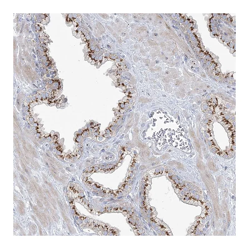Atlas Antibodies Anti-AFTPH Antibody