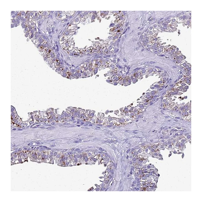 Atlas Antibodies Anti-LRRC10B Antibody